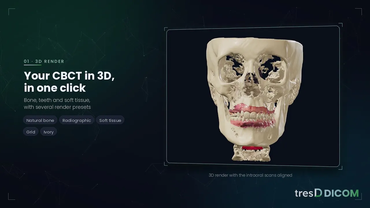 tresD DICOM gallery image
