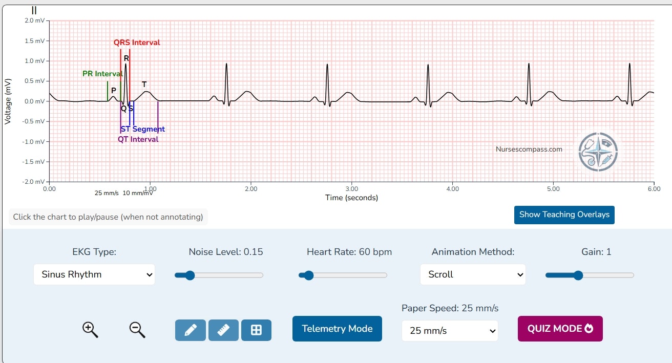 Nurses Compass EKG Simulator gallery image