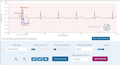 Nurses Compass EKG Simulator gallery image