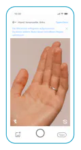 Nia - the eczema app gallery image