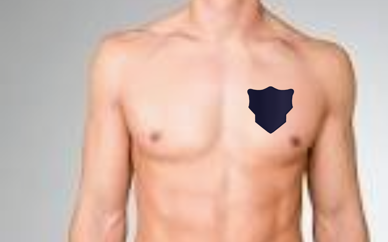 NerveCor gallery image