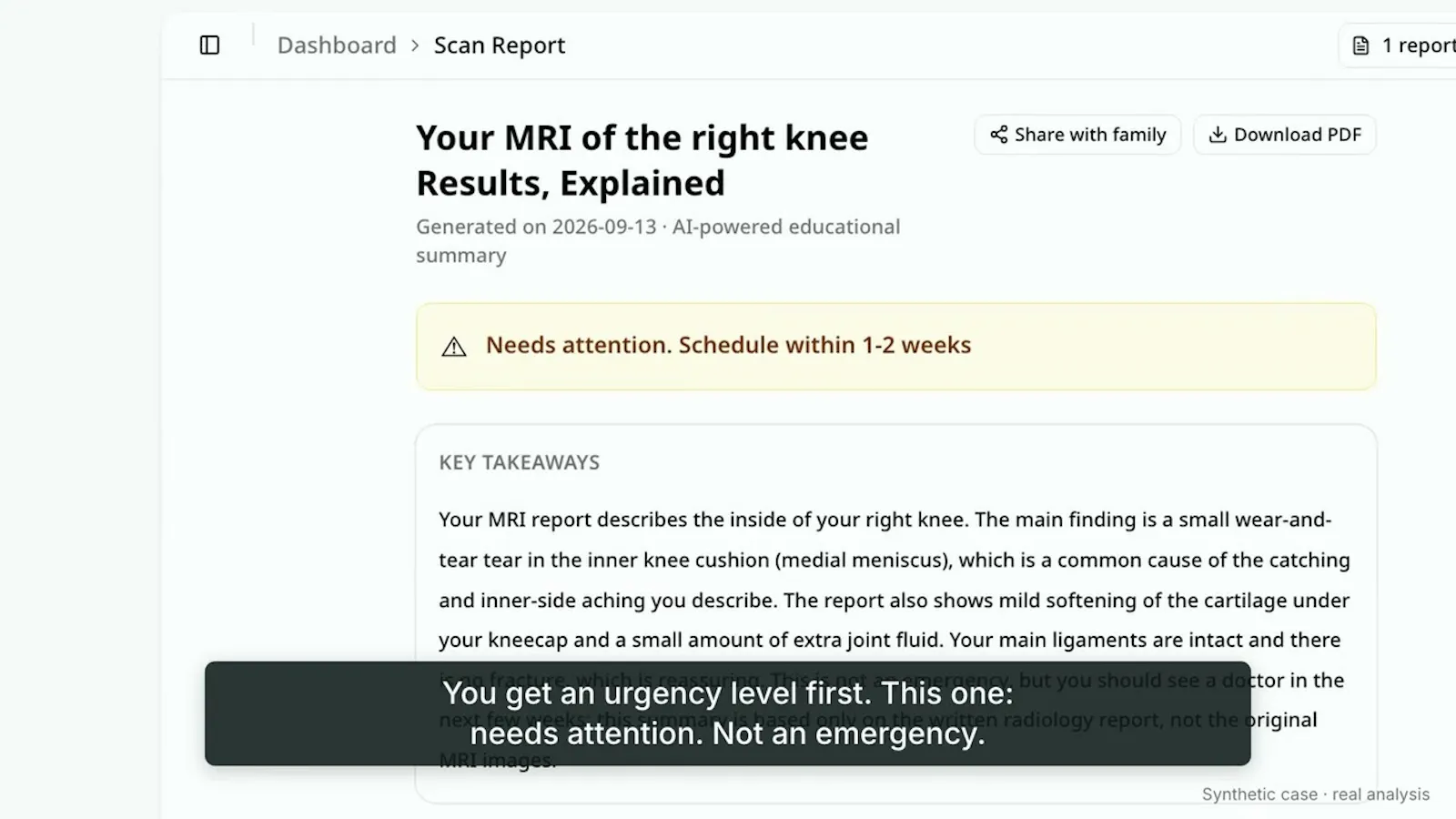 ReadingScan screenshot 1 (video preview)