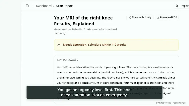 ReadingScan screenshot 1 (video preview)