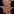 Chin filler