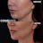 Chin filler