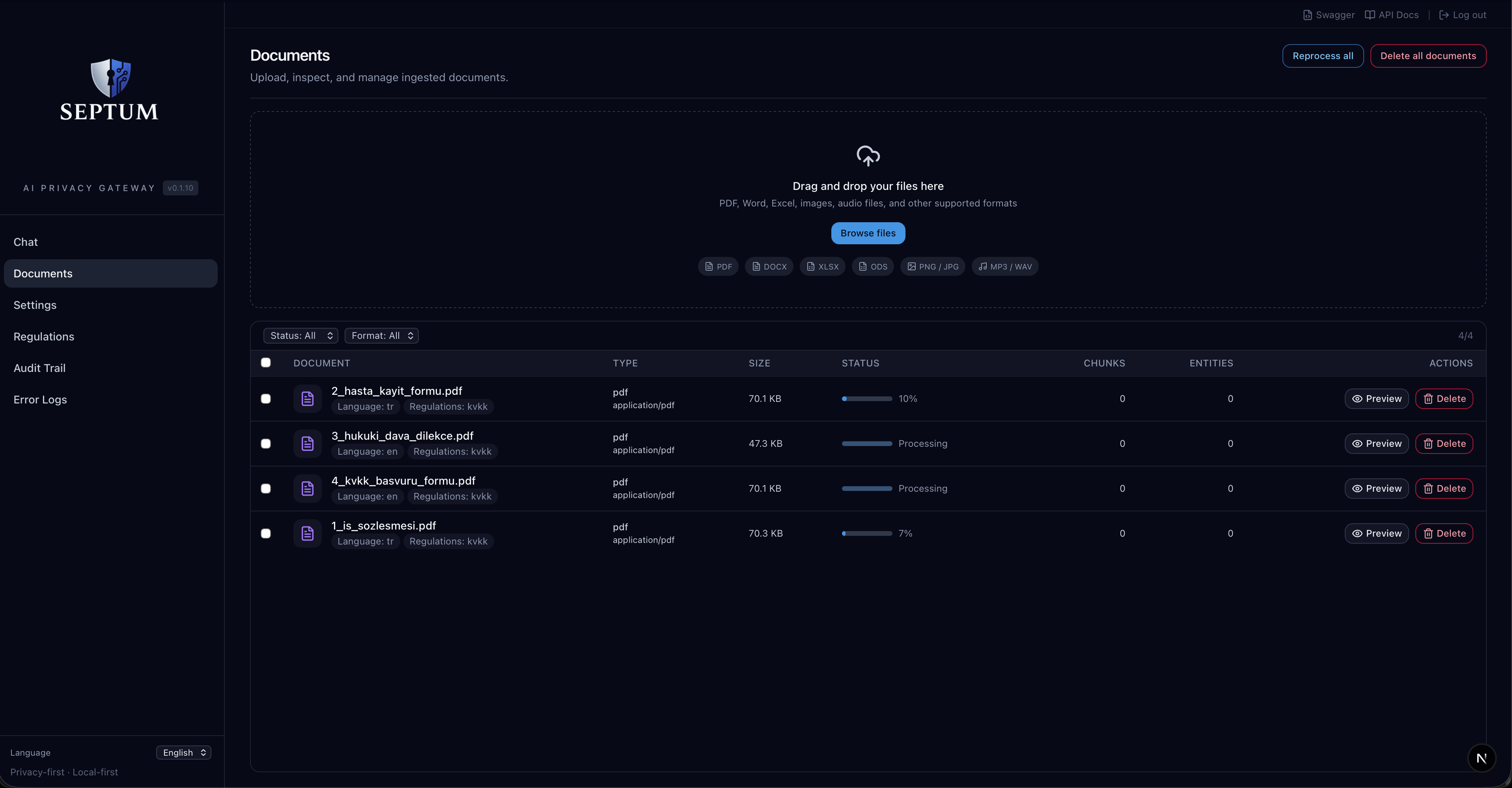 Septum gallery image