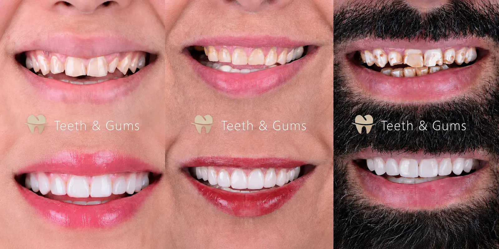 Teeth & Gums screenshot 5