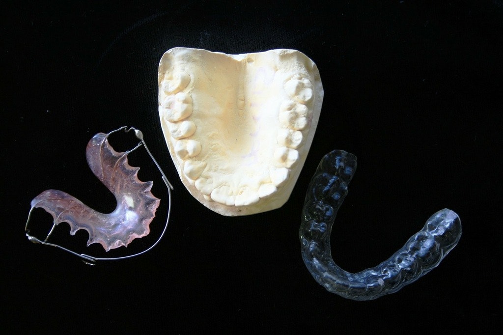 Clear Aligners