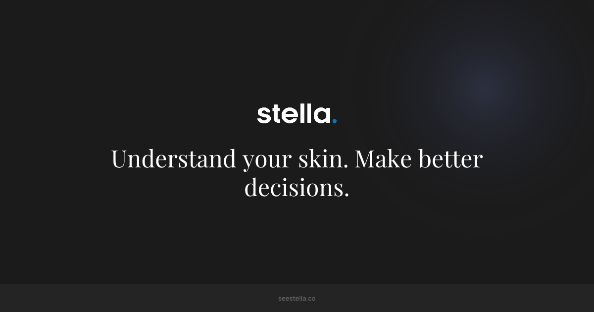 See Stella gallery image
