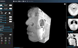 3Dicom - Visualise CT/MRI Scans In 3D media 1