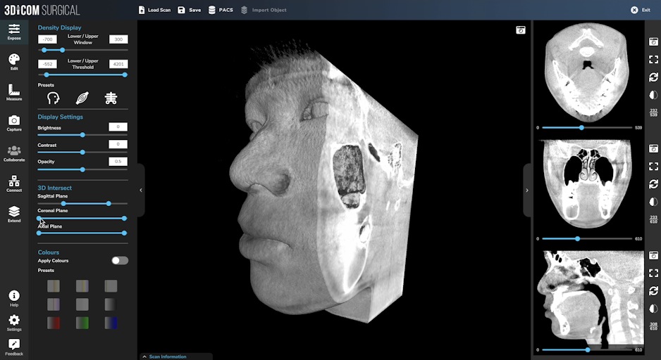 3Dicom Visualise CT MRI Scans In 3D Product Information Latest 3Dicom Visualise CT MRI Scans In 3D Product Information Latest