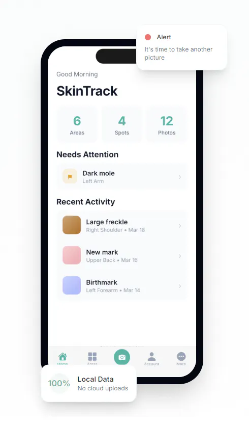 SkinTrack のプロダクトバナー
