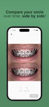 My Braces Tracker gallery image