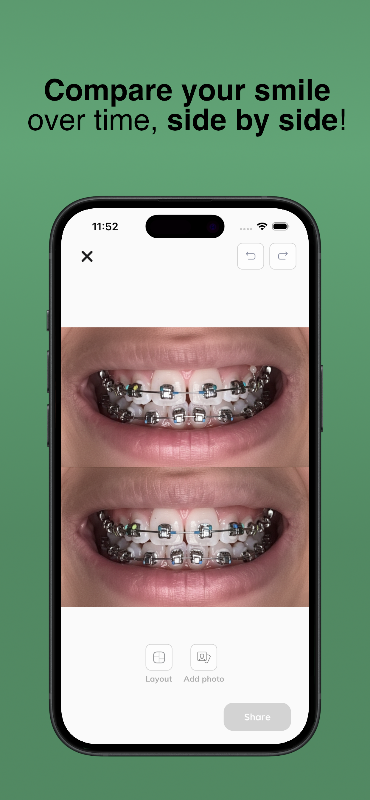 My Braces Tracker - Screenshot 4 showing product features and functionality
