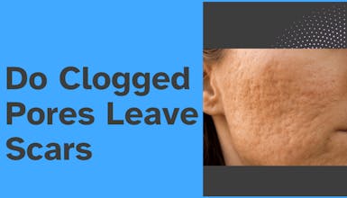 Pore Clogger Checker gallery image