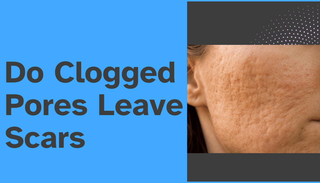 Pore Clogger Checker media 1