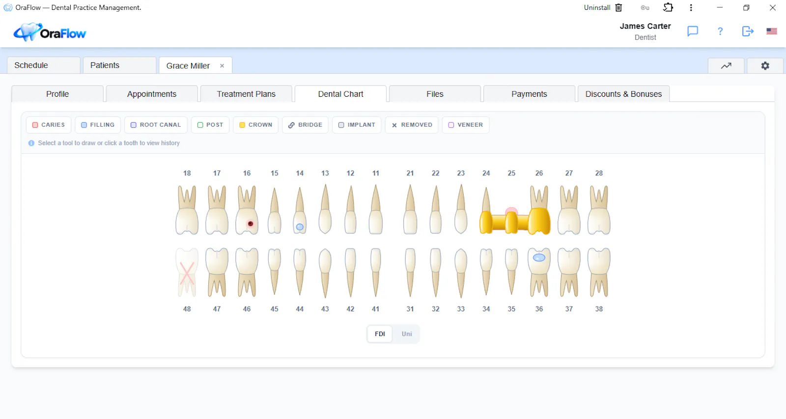 OraFlow screenshot 2