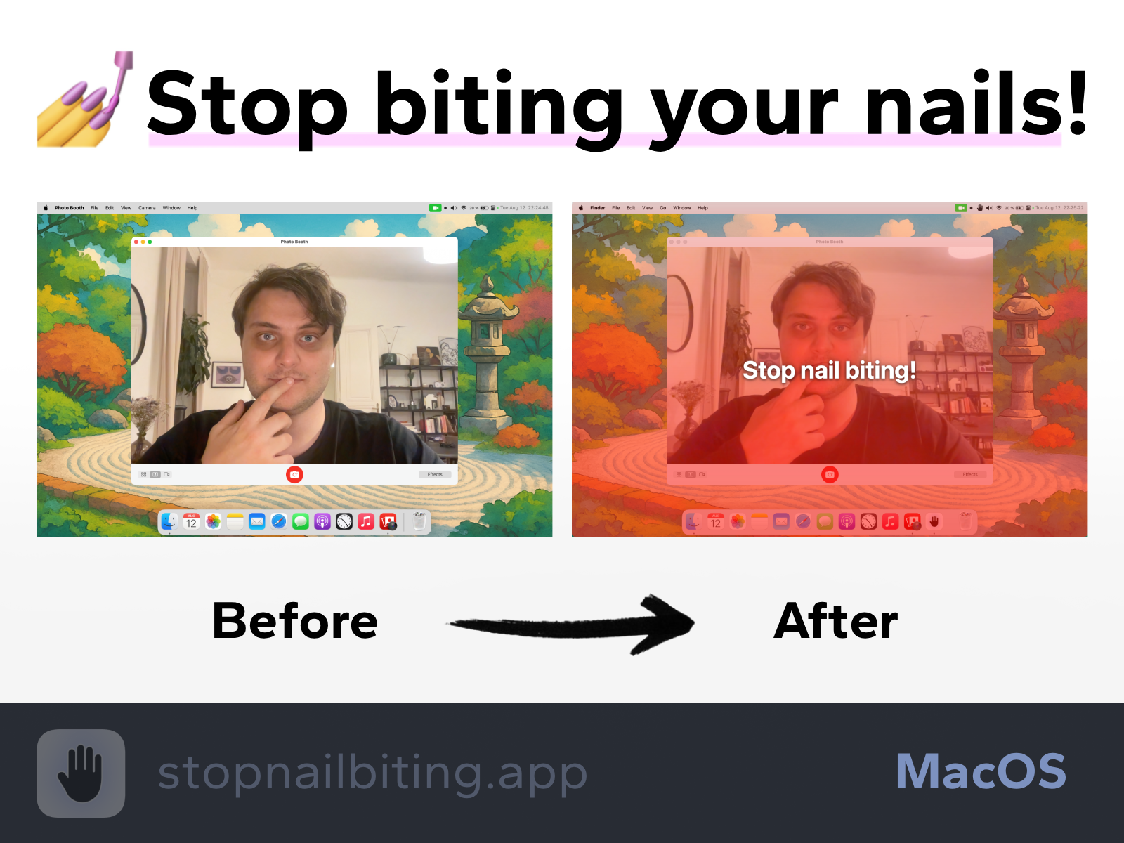 stopnailbiting.app медиа 2