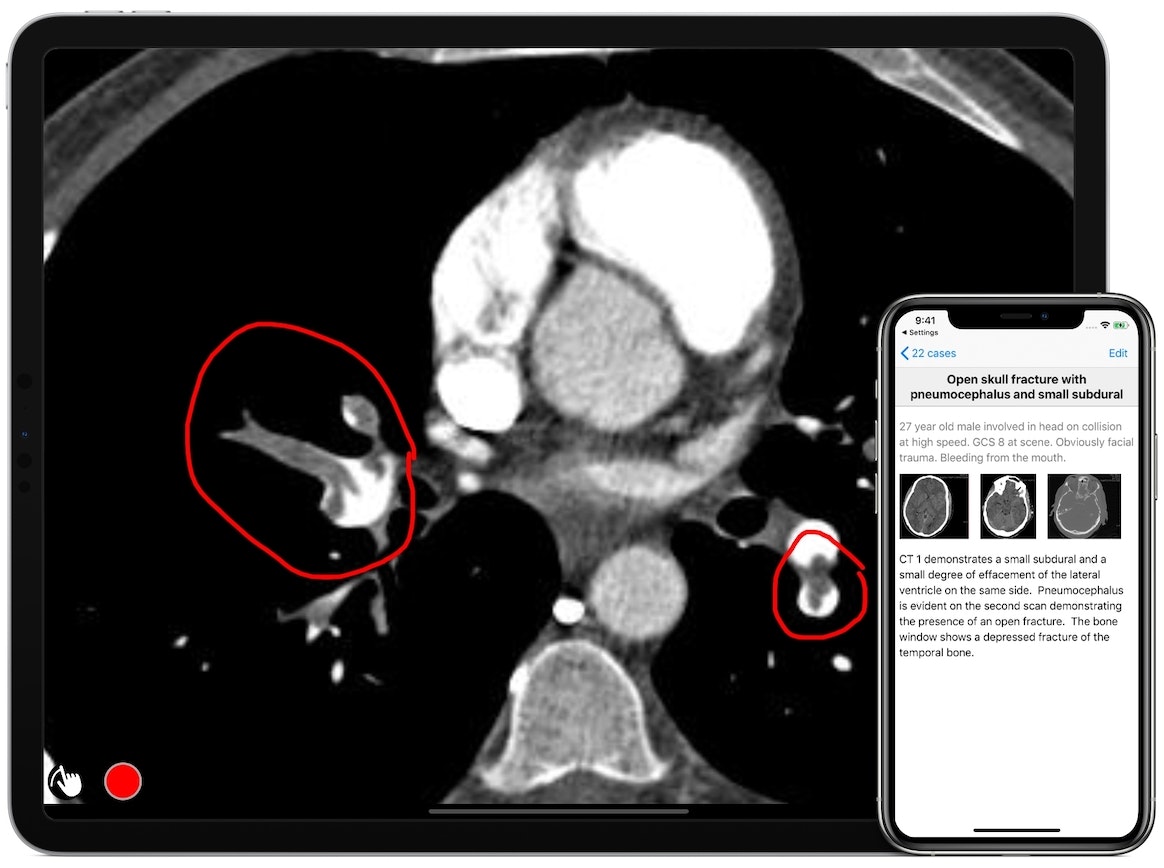 Case Collection gallery image