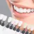 Onyx Smile Teeth Whitening Kit