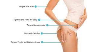 Velashape 3 Behandlung in Dubai