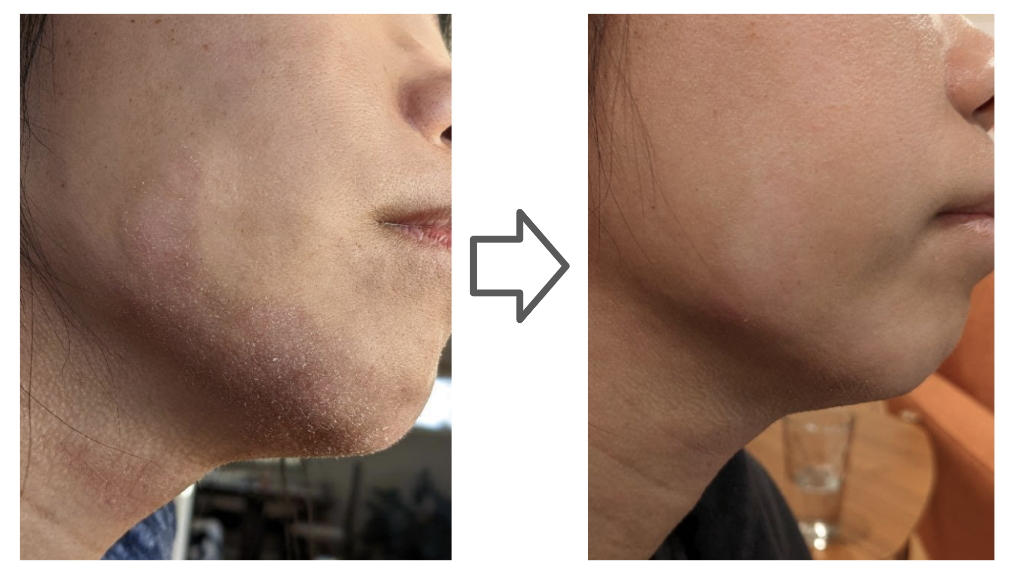 Soteri Skin gallery image