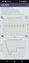 Polar H10 Fibrillation Search gallery image