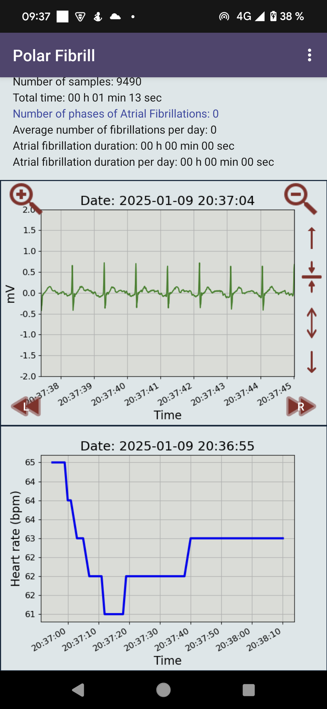 Polar H10 Fibrillation Search - Screenshot 3 showing product features and functionality