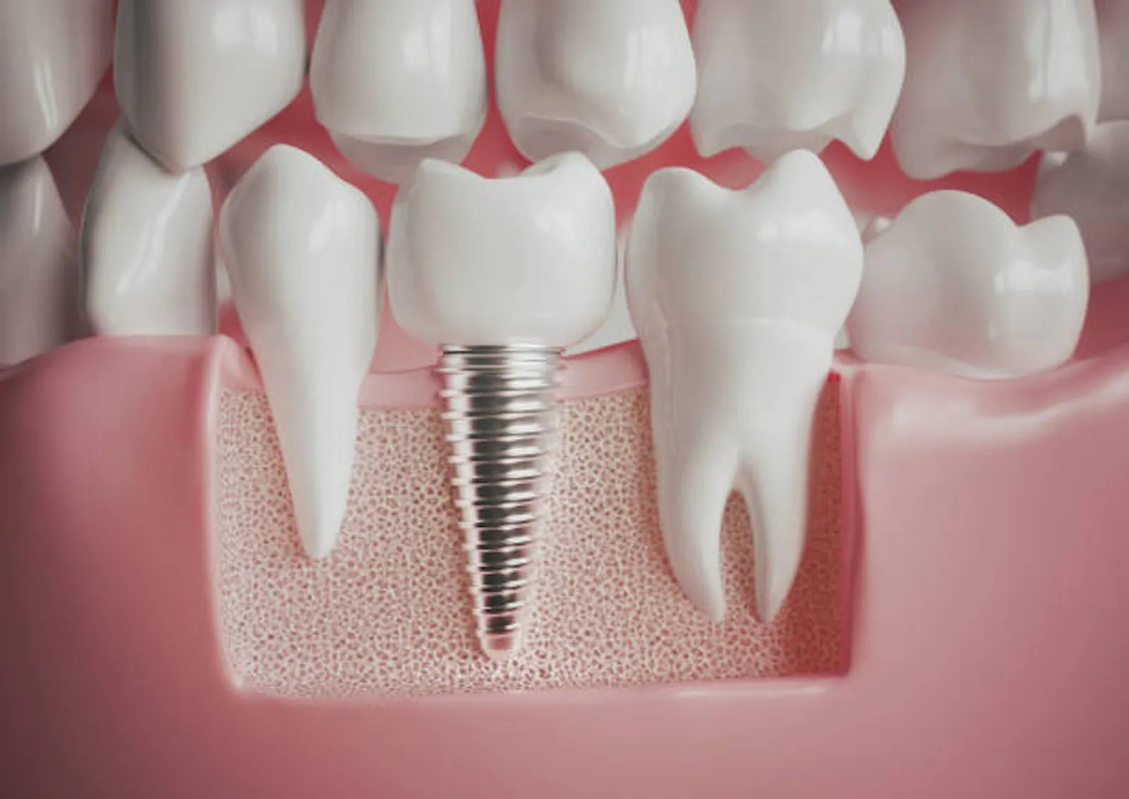 Best Dental Implant Clinic Malviya Nagar screenshot 1