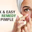 Pimple Kyo Hote Hai | Acne Treatment