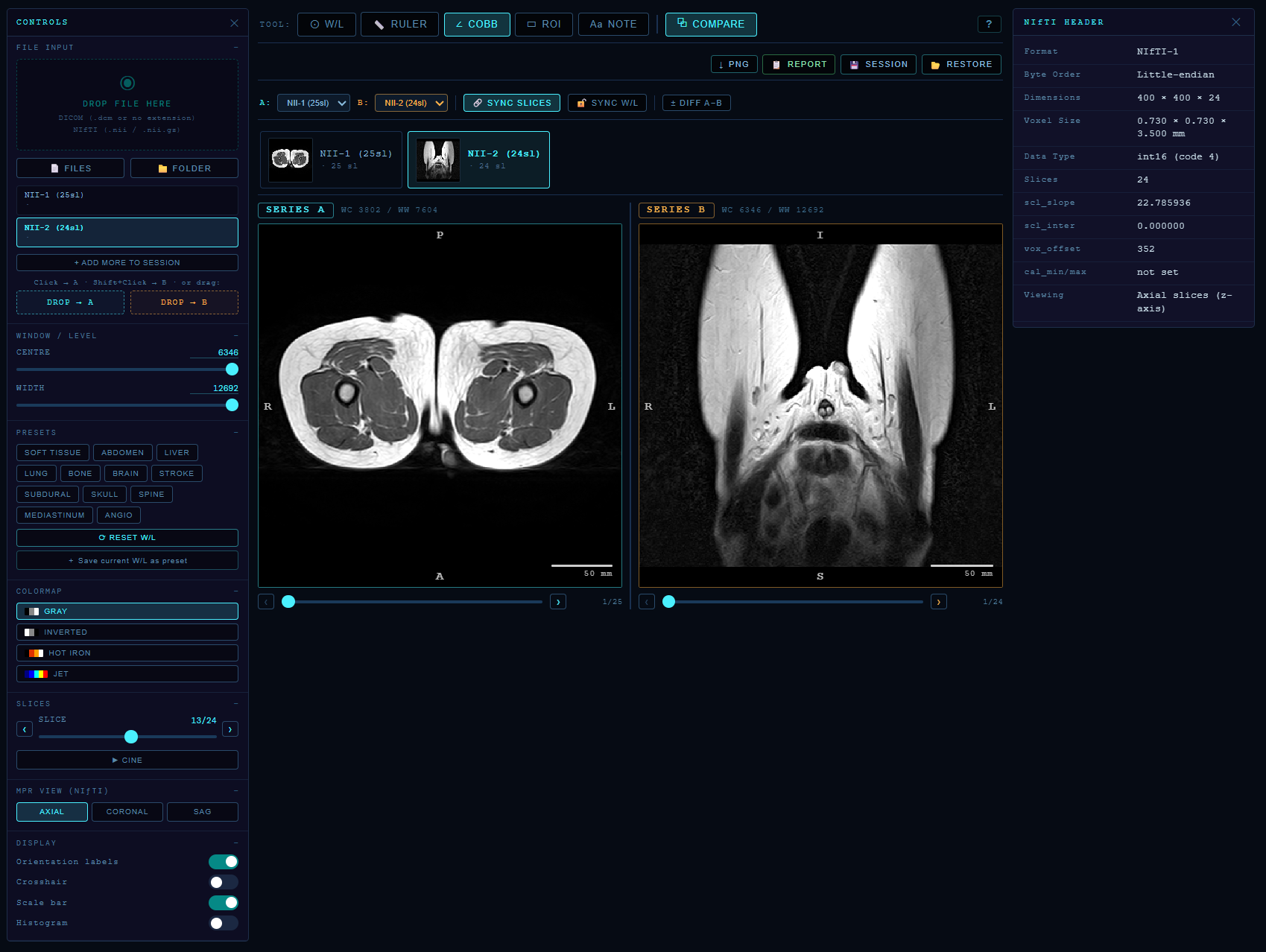 Scan Instant gallery image