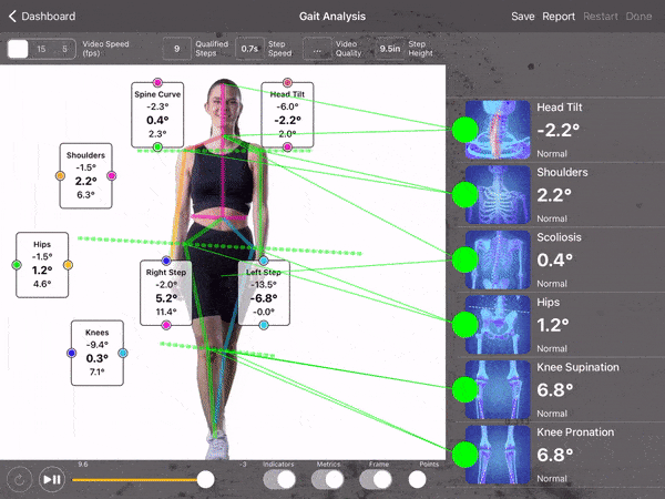 Mídia 4 de Se encaixa perfeita: órteses personalizadas - 3D Digitalize seus pés - Personalize com A.I.- Lar entregue