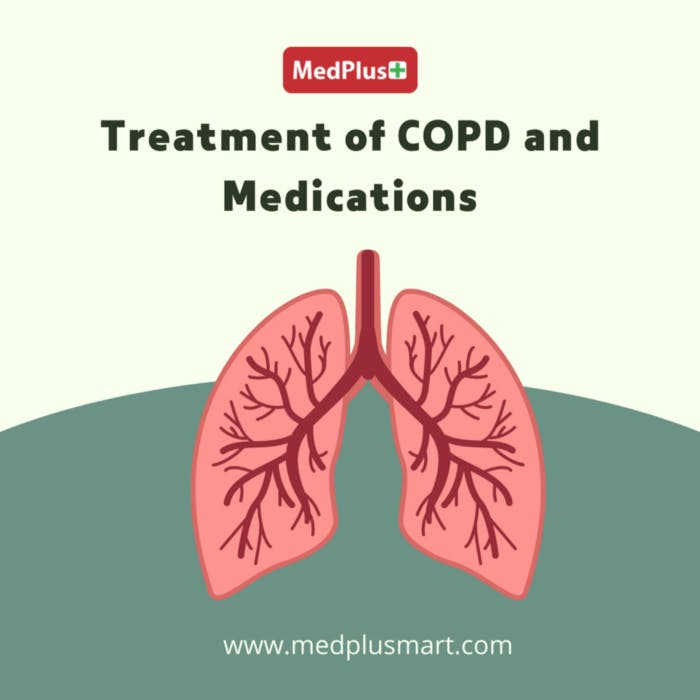 Treatment of COPD media 1