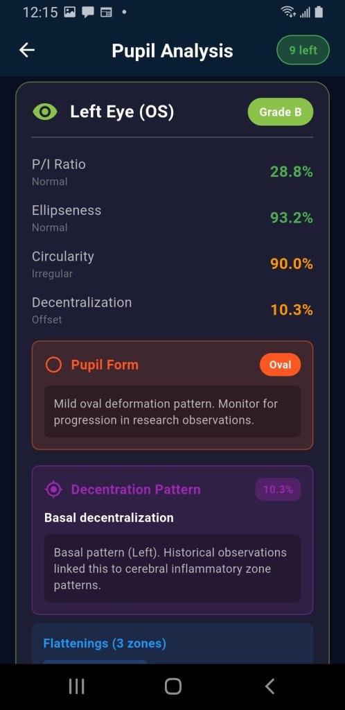 PupilMetrics Research Tool gallery image