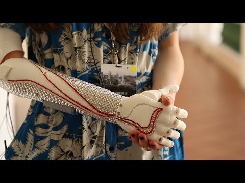 Open Bionics gallery image