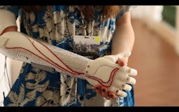 Open Bionics media 1