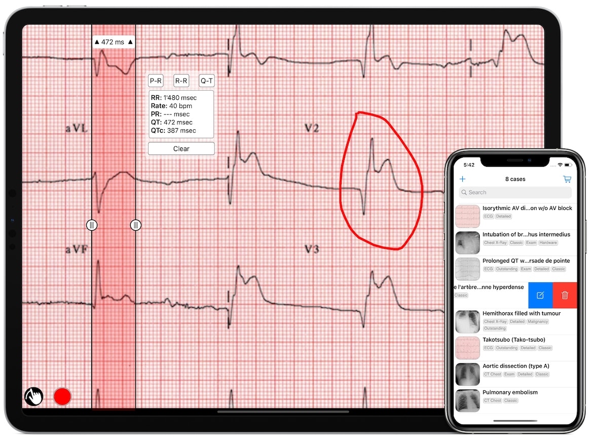 Case Collection gallery image
