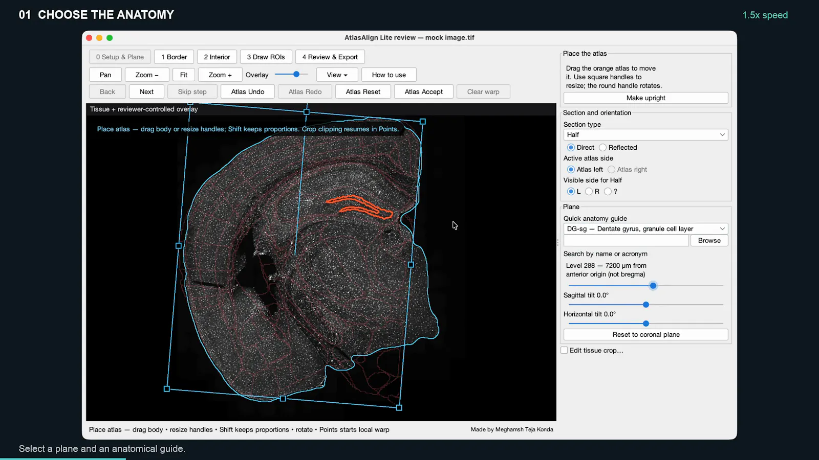 AtlasAlign screenshot 3