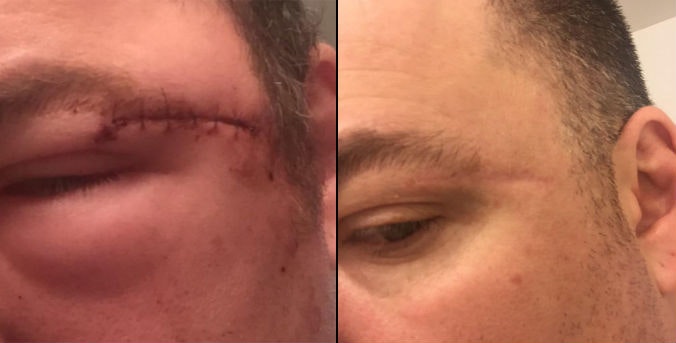 NewGel+ gallery image