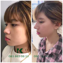 tham my sua mui dep nhat gallery image