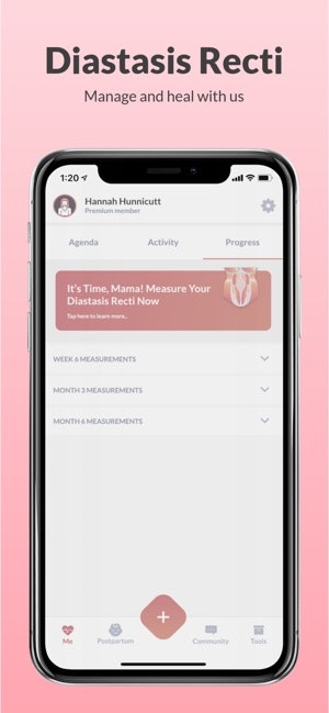 The SnapBack gallery image