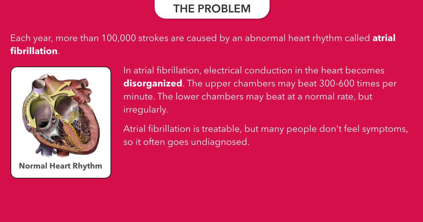 The mRhythm Study gallery image