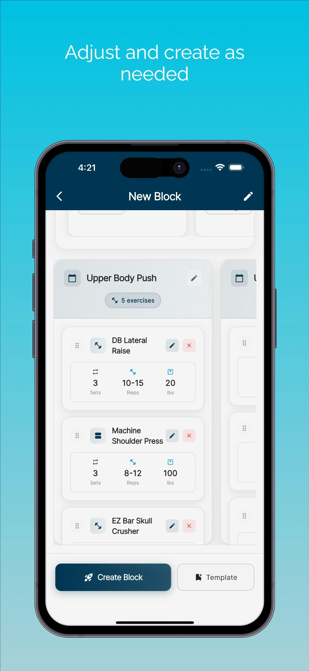 SetSense gallery image