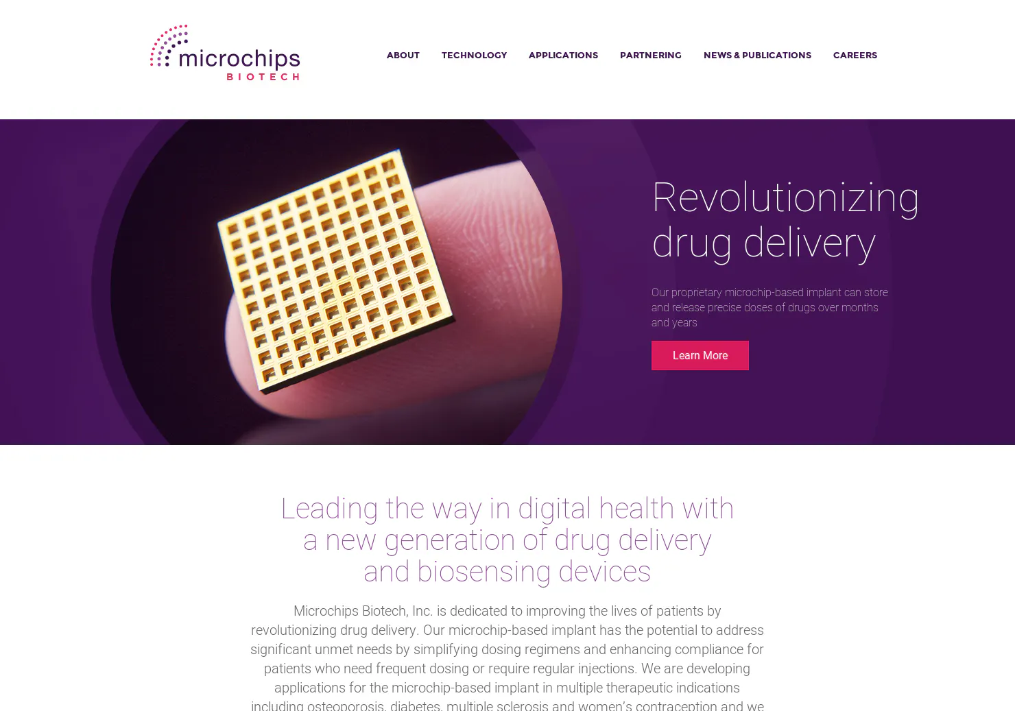 MicroCHIPS