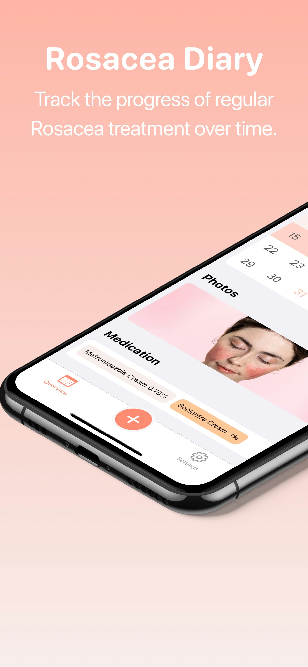 Media Nhật ký Rosacea 1