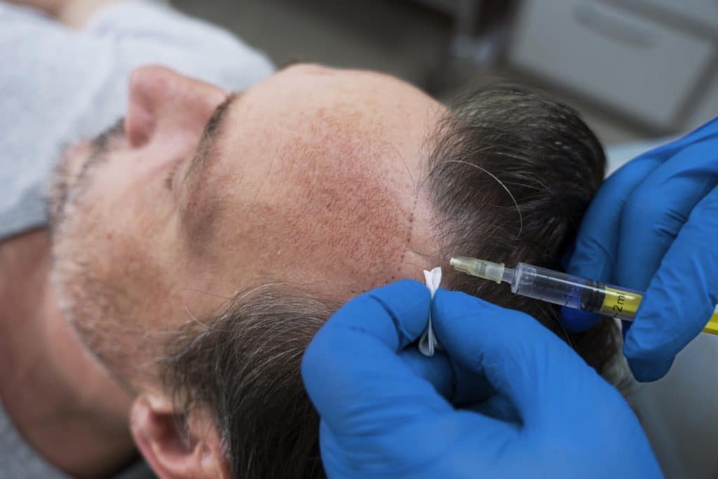 PRP Treatment in Kochi