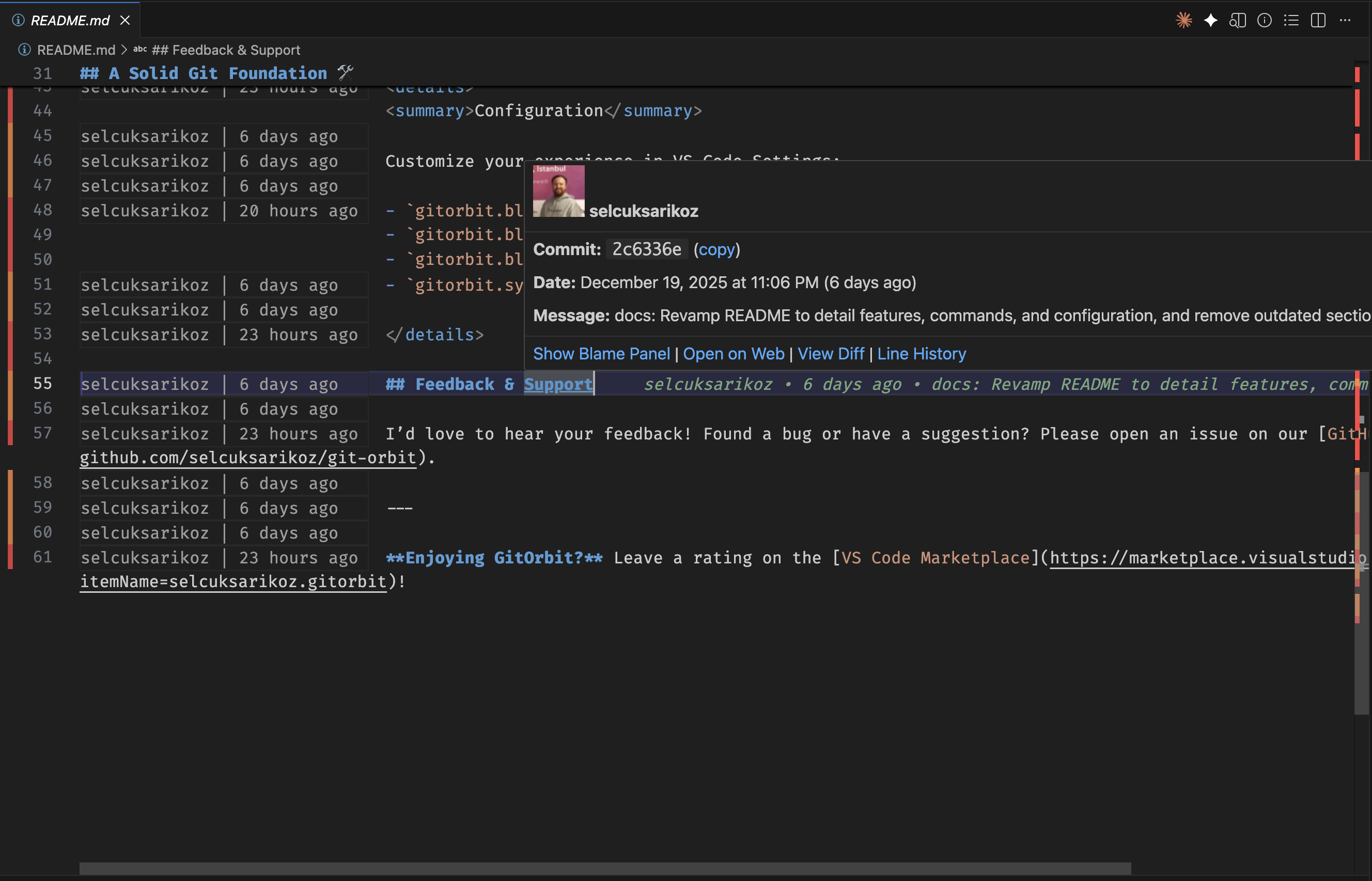 GitOrbit - Git Management for Vscode gallery image