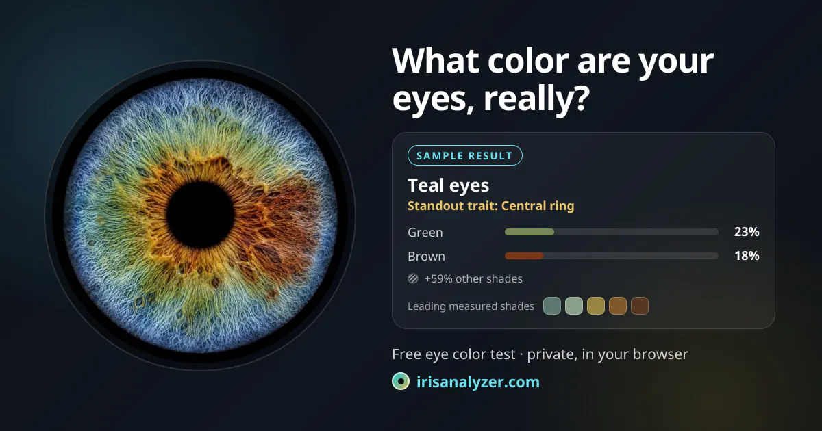 Iris Analyzer gallery image