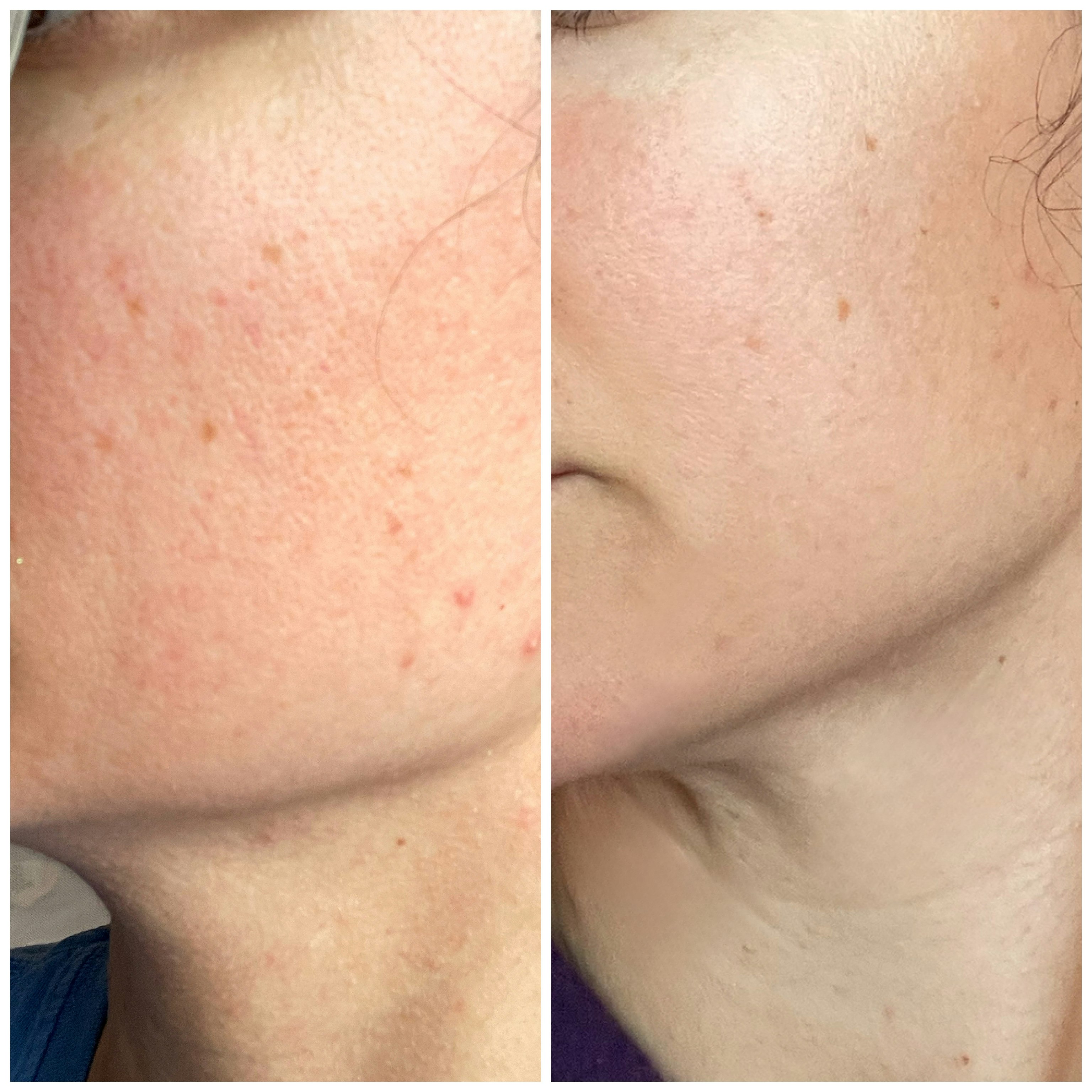 Mídia 2 de Finalmente tudo natural - Óleo de face revitalizante premiado