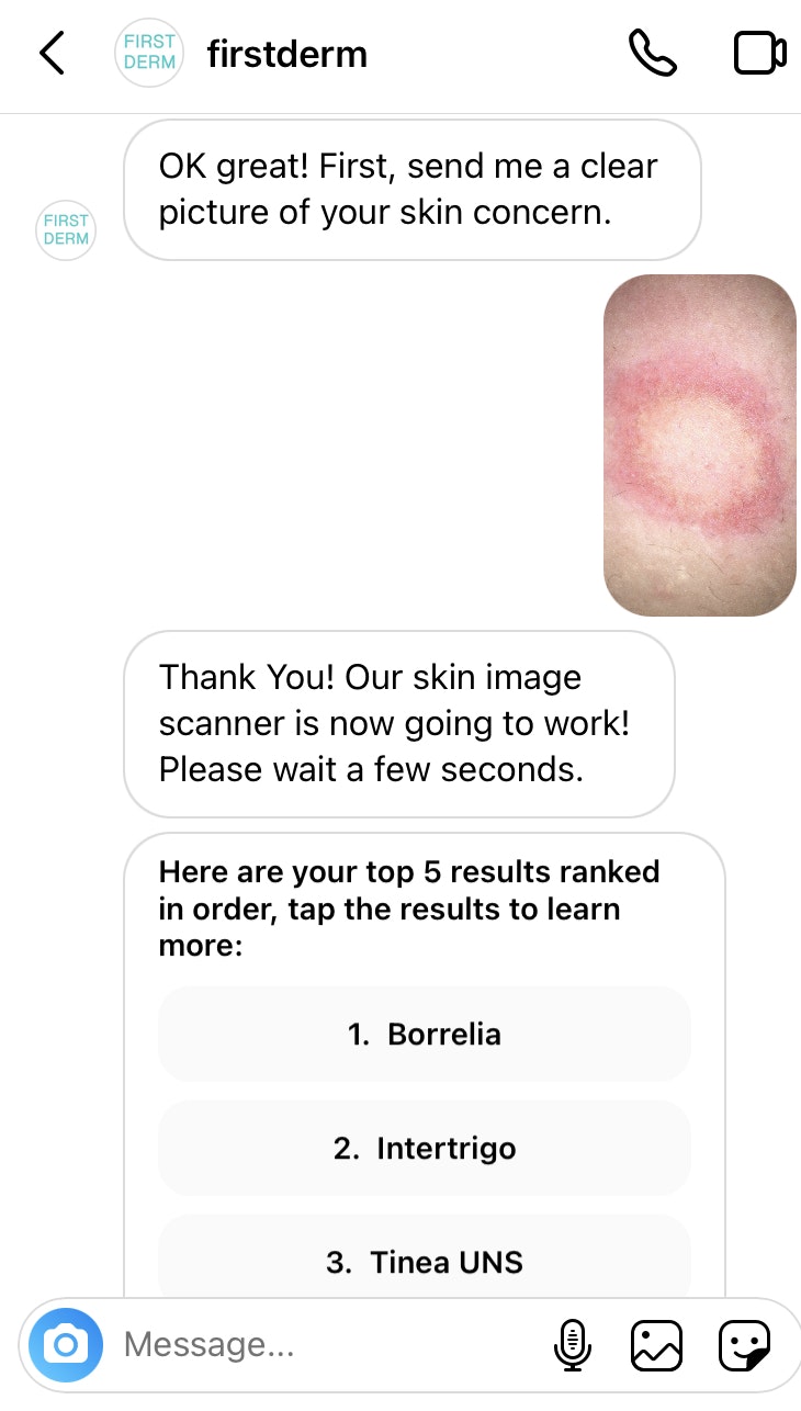 Instagram Direct Message Dermatology Bot gallery image